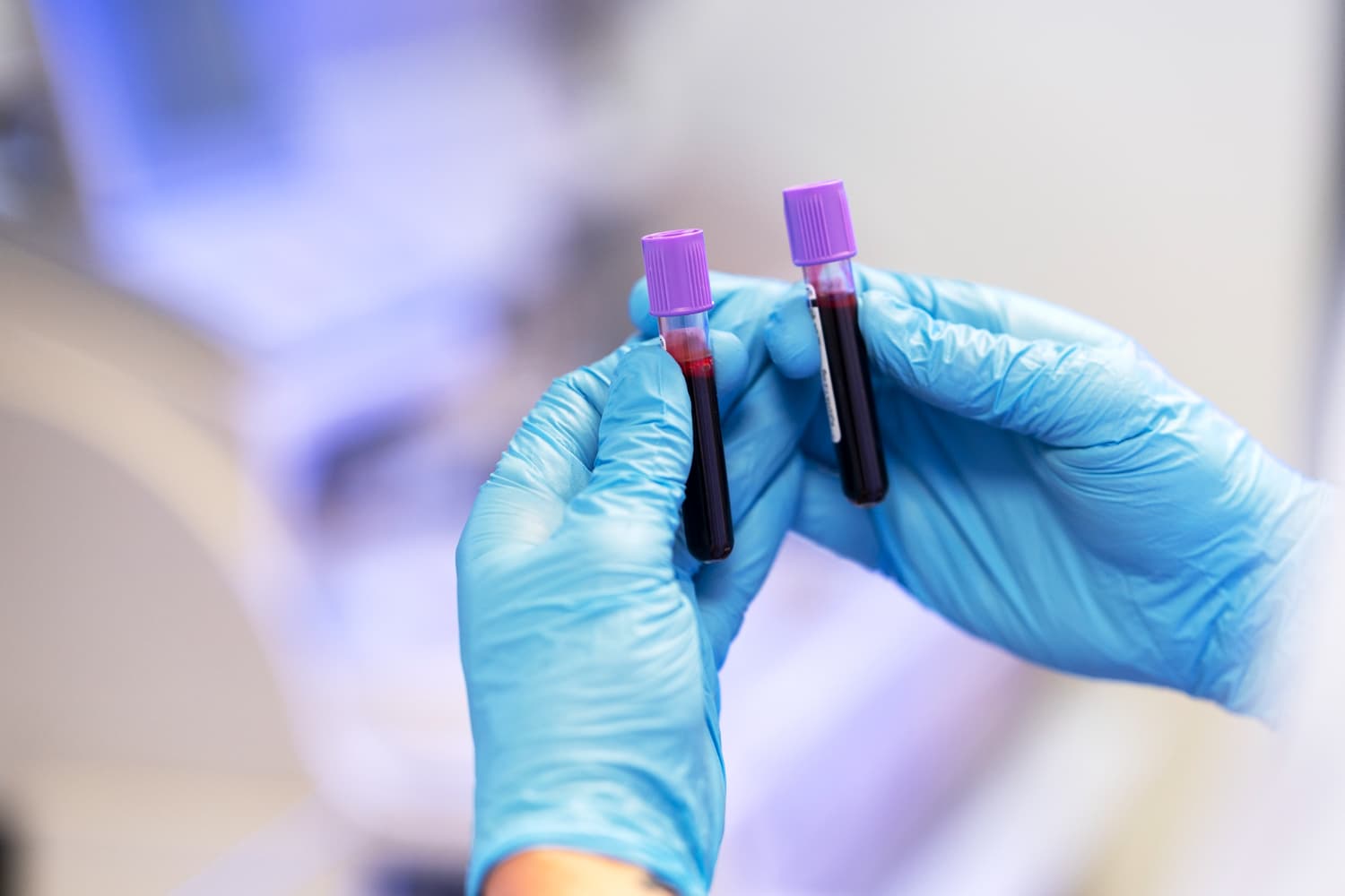 Diagnosta laboratoryjny w rękawicach trzyma probówki z materiałem do badań